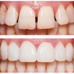 Teeth correction by Dental Associates, Inc.